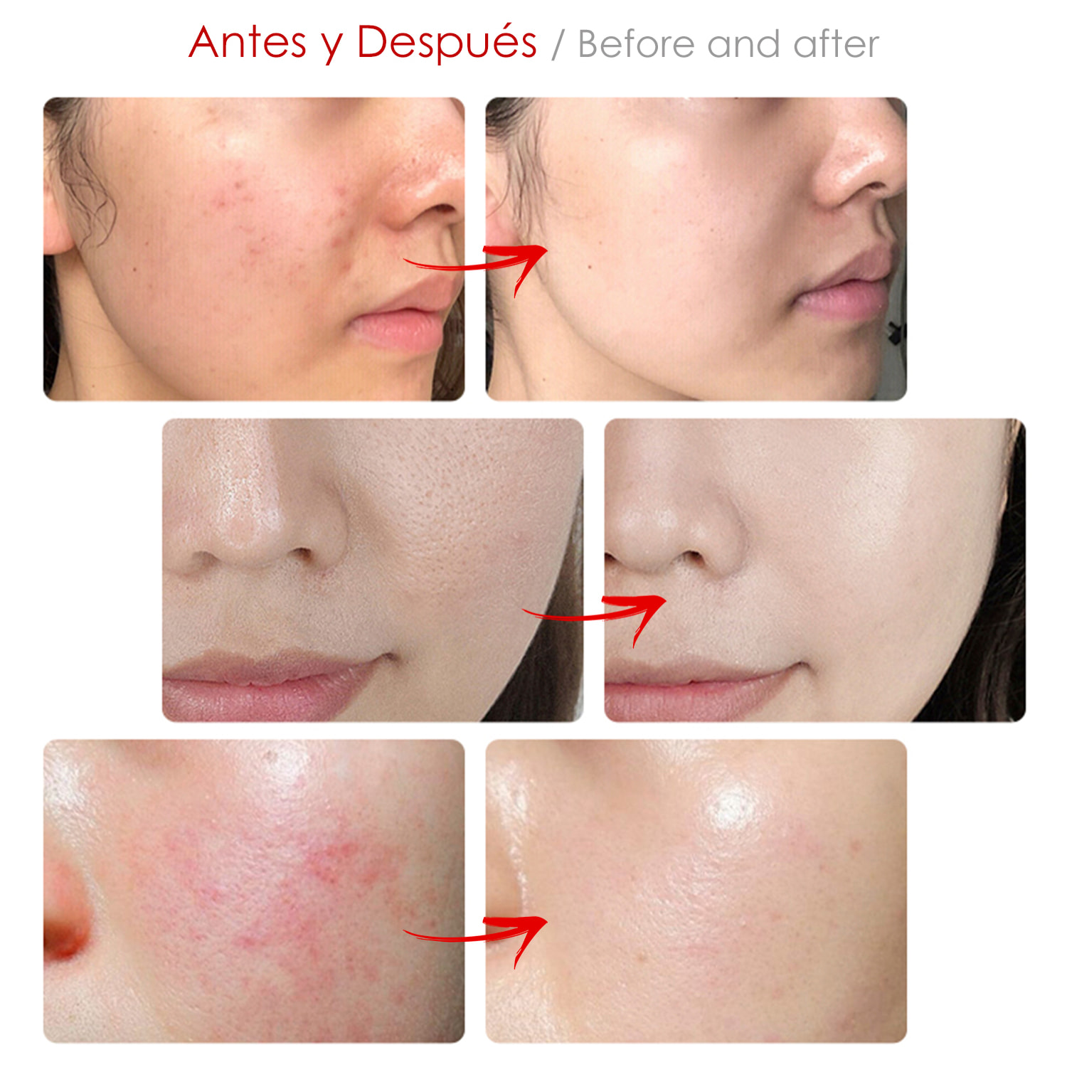 Maschera per il trattamento della pelle leggera. Cura del viso, anti invecchiamento, ringiovanimento della pelle.
