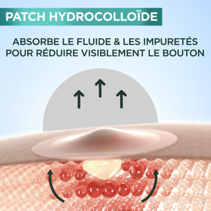 Garnier SkinActive PureActive Pimple Patch (x22)