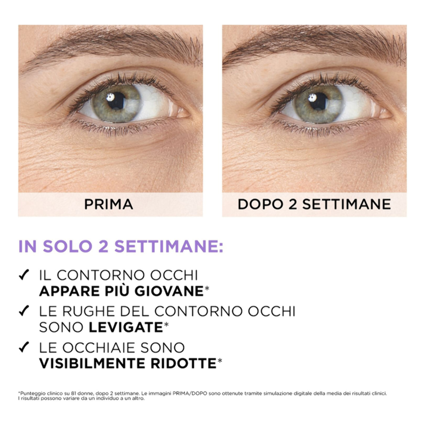Siero Contorno Occhi Antirughe Revitalift Filler Idratante Energizzante Levigante Rinfrescante con Acido Ialuronico e Caffeina - Flacone da 20ml