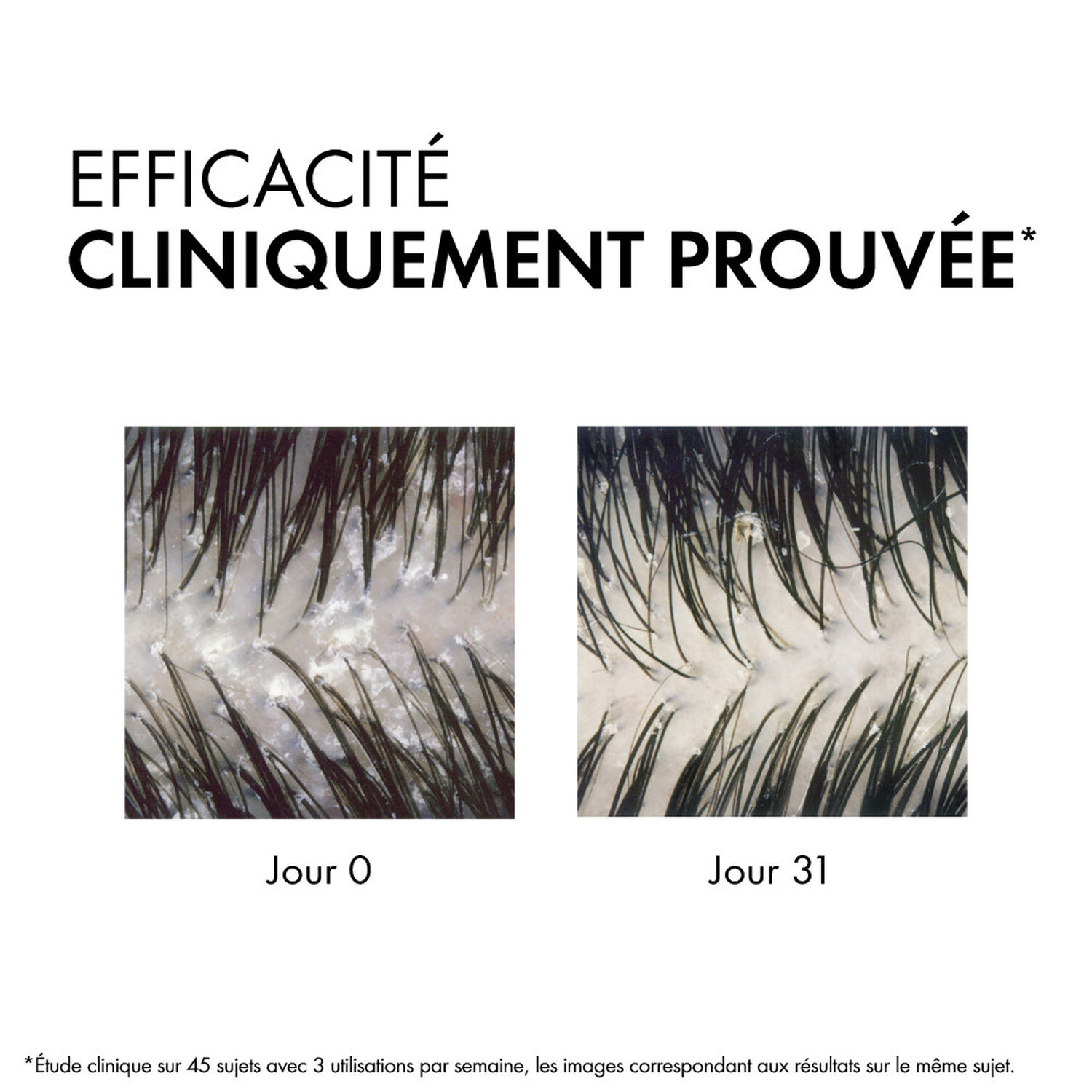 Dercos Technique - Shampooing Anti-Pelliculaire Traitant Pellicules - Cheveux Secs