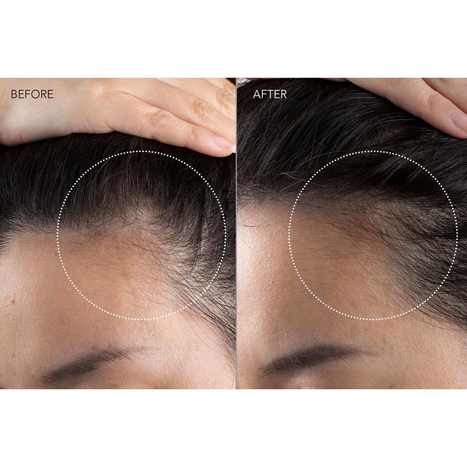 FAQ™ 301 - Appareil de Massage LED - Stimulation de la Pousse des Cheveux