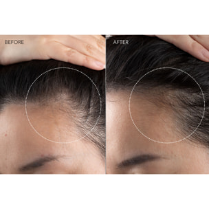 FAQ™ 301 - Appareil de Massage LED - Stimulation de la Pousse des Cheveux