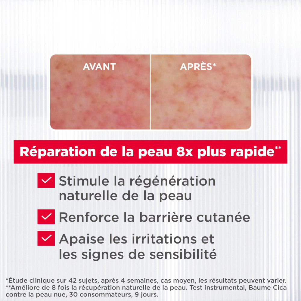 Mixa Expert Peaux Sensibles Baume réparateur pour peaux sèches irritées