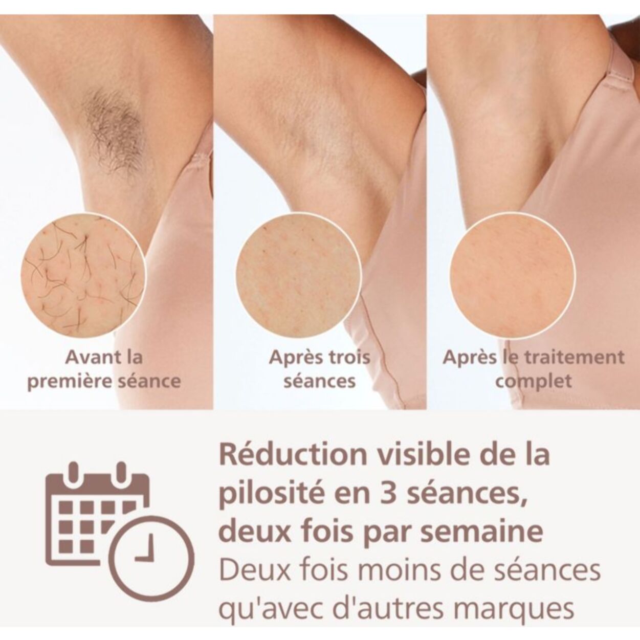 Epilateur lumière pulsée PHILIPS BRI945/00 Lumea Prestige