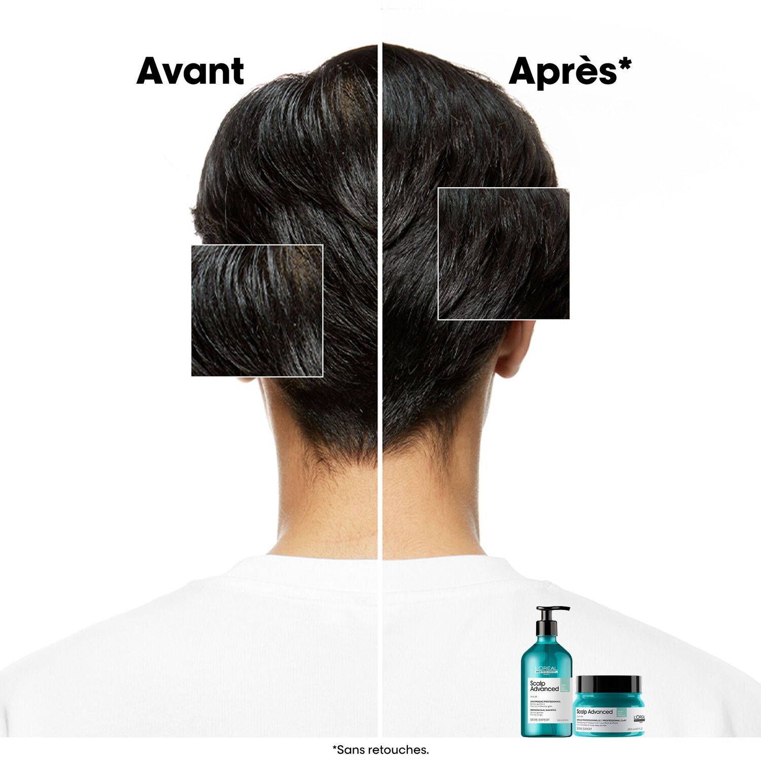 Scalp Advanced - Shampooing Dermo-Purifiant - Cuirs Chevelus Gras 500 ml