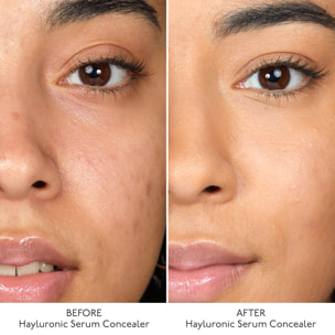 Hyaluronic Serum Concealer - Anti-Cernes Ultra Soin