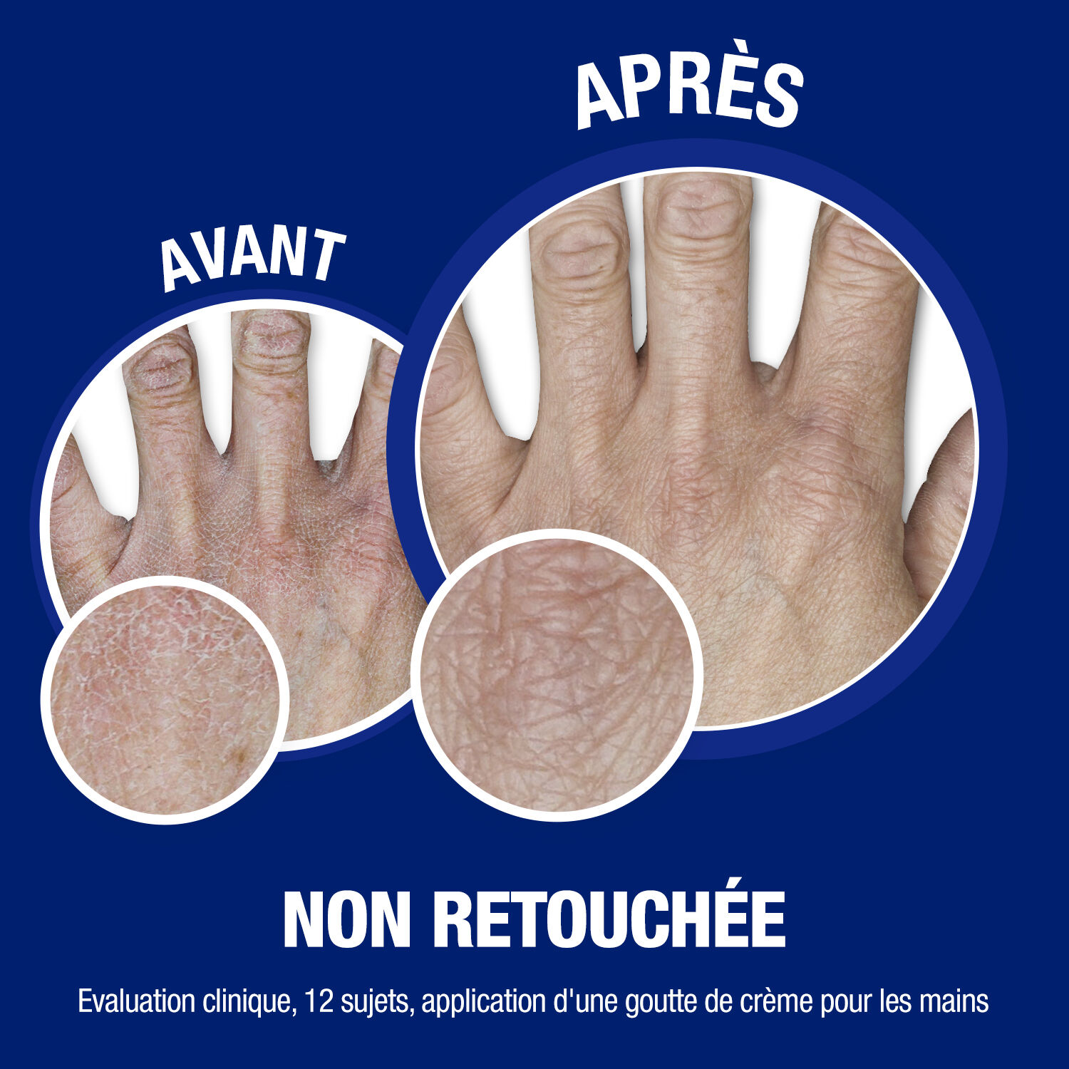Crème mains - NEUTROGENA® Mains Crème Mains Hydratante concentrée 50 ml