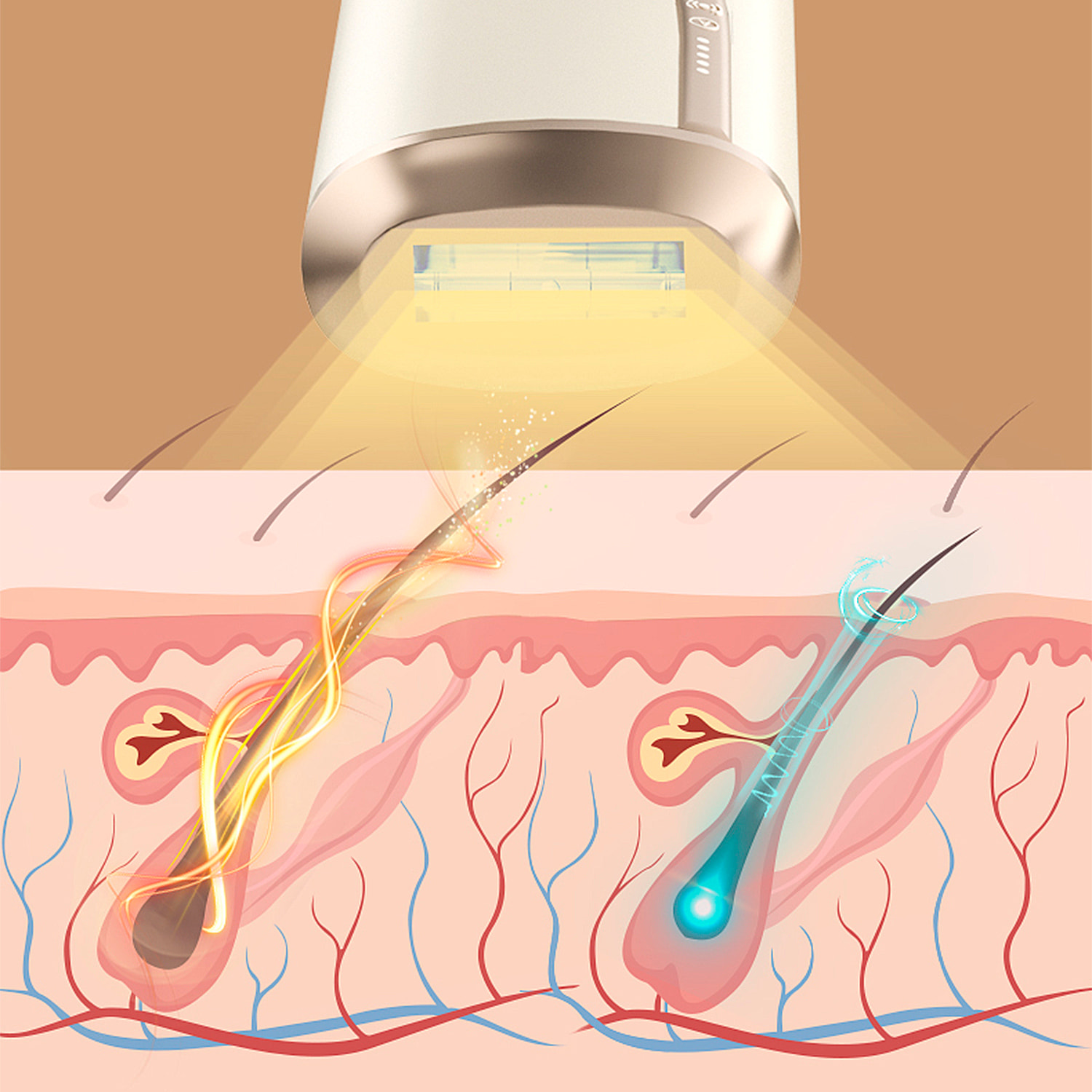 Epilatore IPL a luce pulsata. 5 livelli di potenza e scatti di flash illimitati.