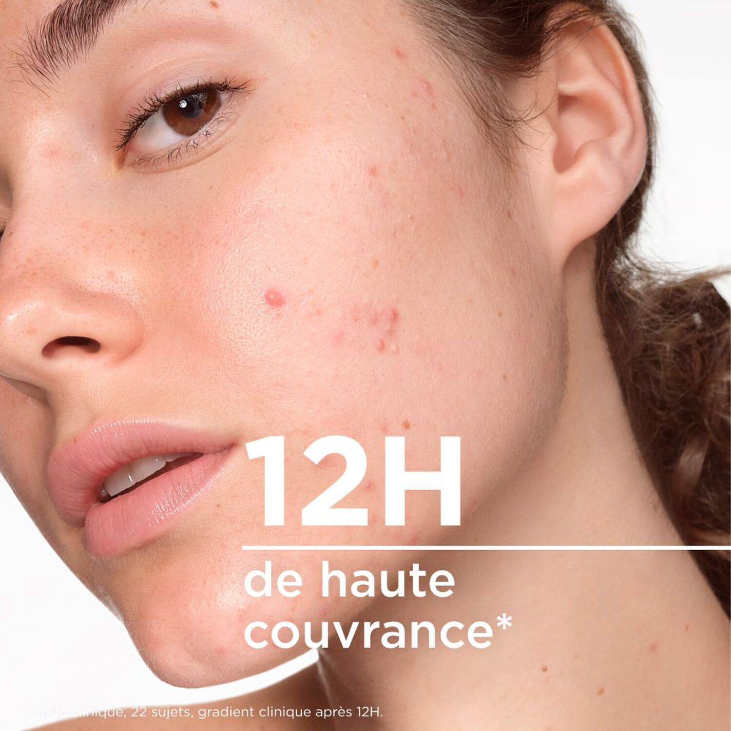 Sébium - Kérato+Cover Gel-Crème Teinté Anti-Imperfections Haute Tolérance 30 ml