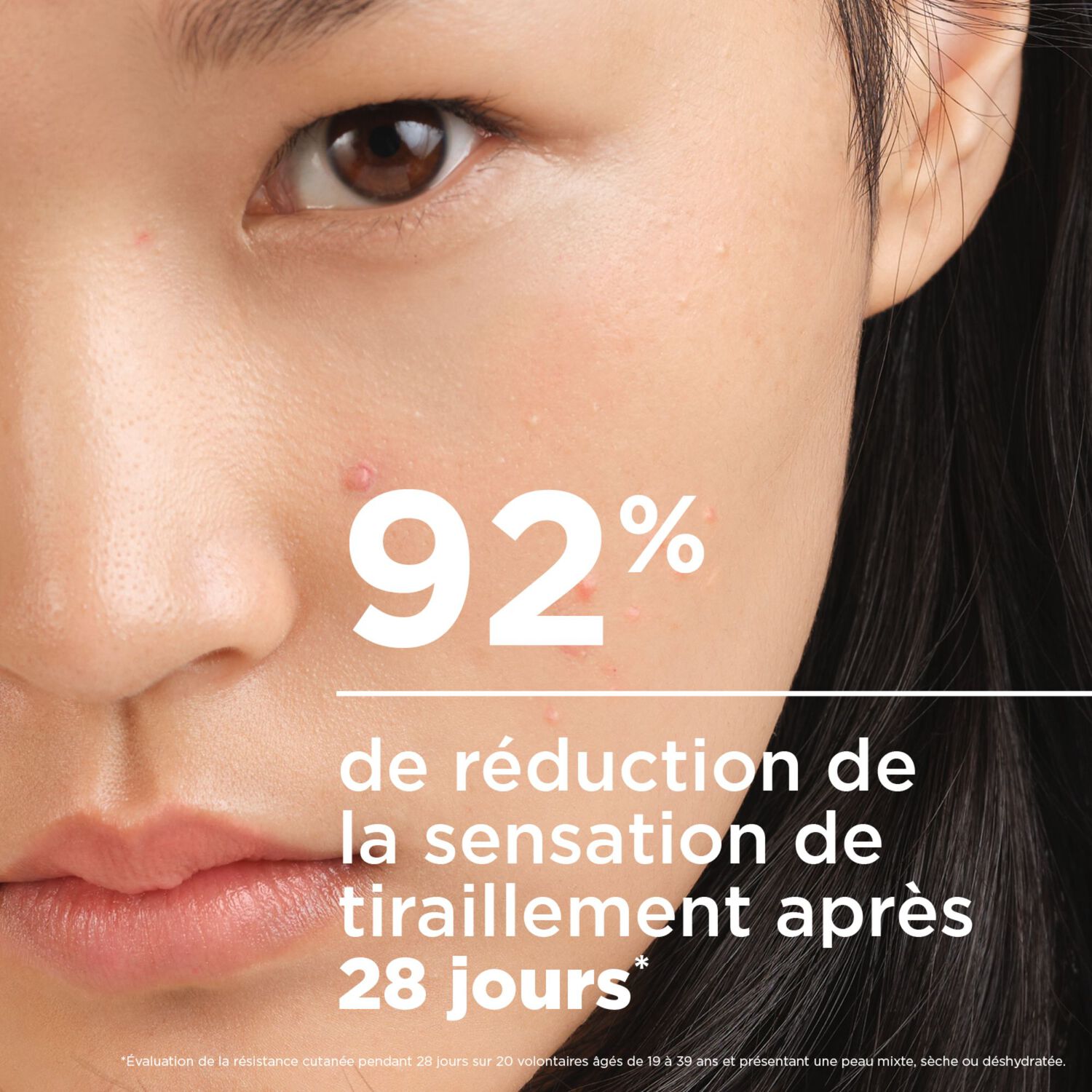 Sébium Sensitive - Soin Apaisant Anti-Imperfections - Peaux Sensibles à Tendance Acnéique 30 ml