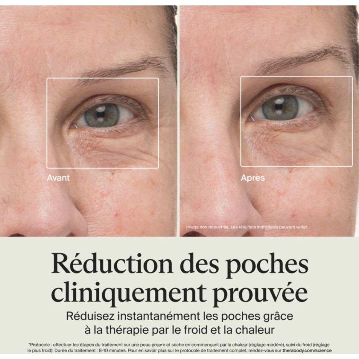 Appareil éclat visage THERABODY TheraFace anti-cernes blanc