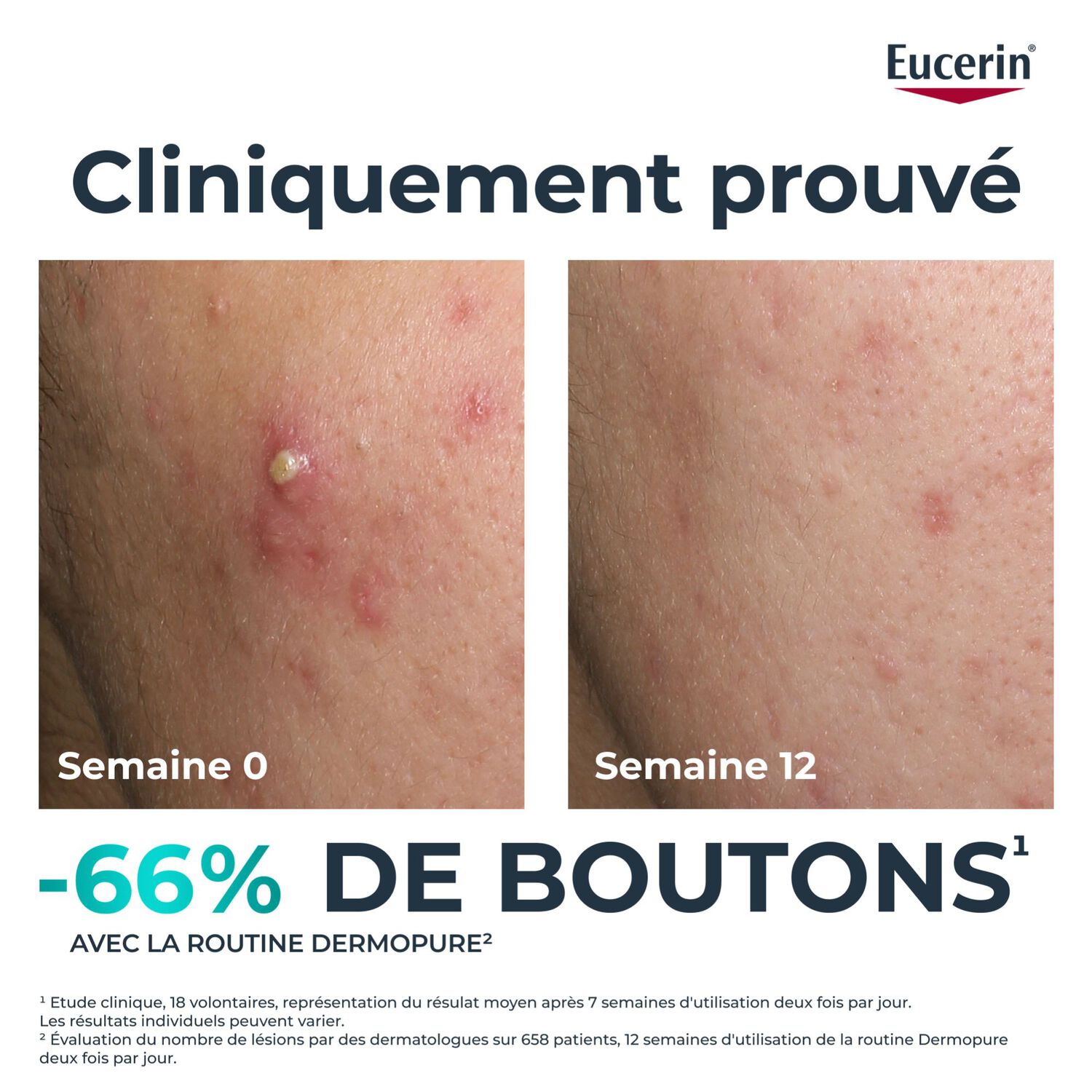 DermoPure Clinical - Fluide Triple Action