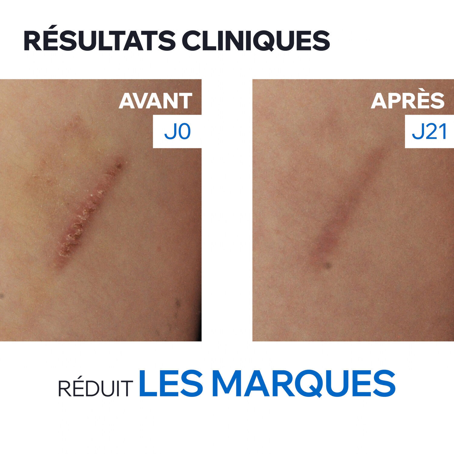 Bariederm Cica+ - Crème Réparatrice Marques Cicatricielles 40ml