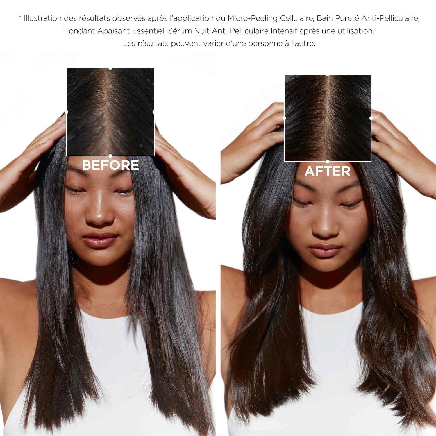 Symbiose - Shampoing anti-pelliculaire purifiant pour cuir chevelu gras et sensible