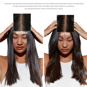 Symbiose - Shampoing anti-pelliculaire purifiant pour cuir chevelu gras et sensible