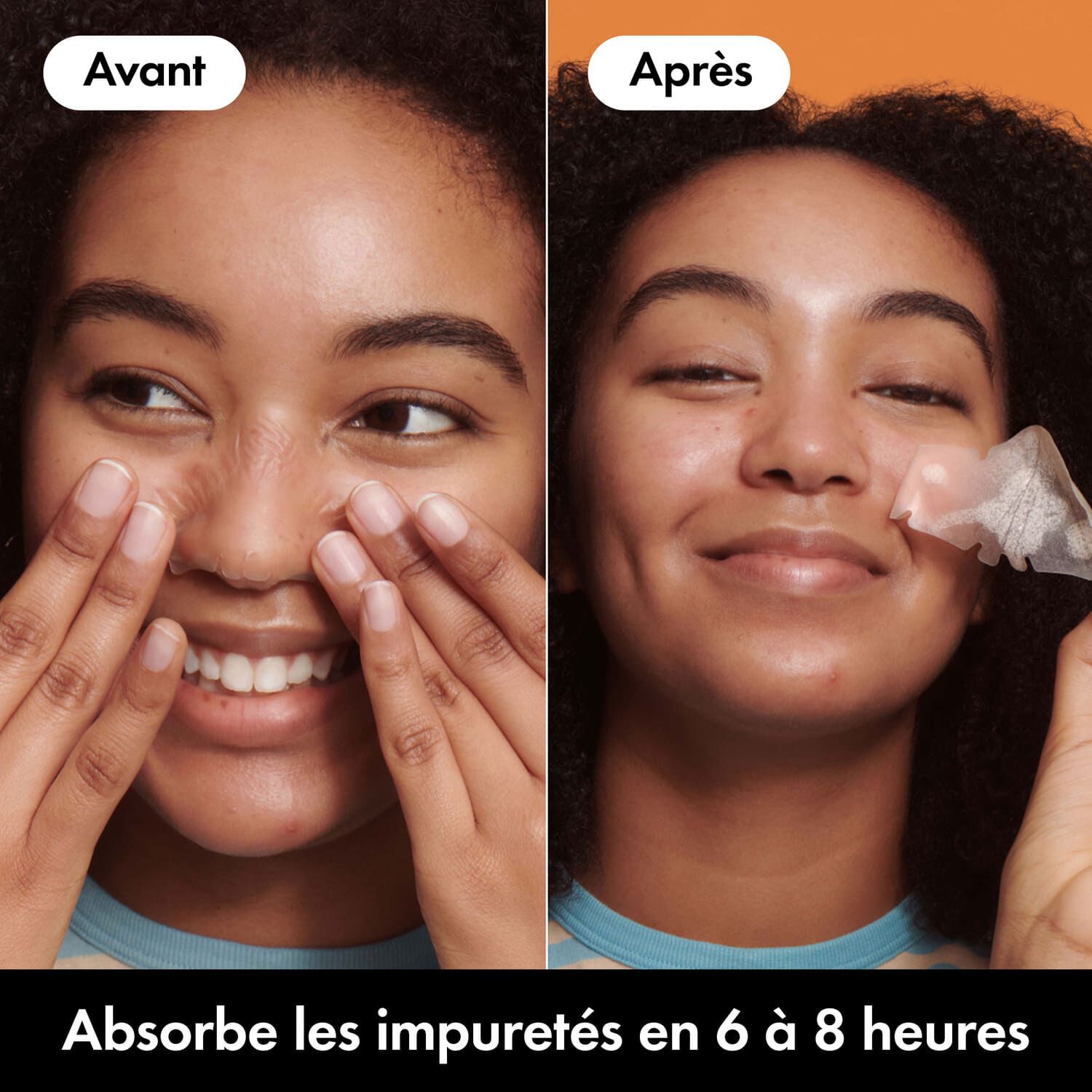 HERO Mighty Patch - Patchs Anti-Acné Nose 10 Patchs