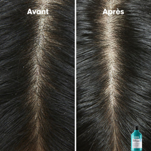 Scalp Advanced - Shampooing Dermo-Clarifiant - Cuirs Chevelus à Pellicules 300 ml