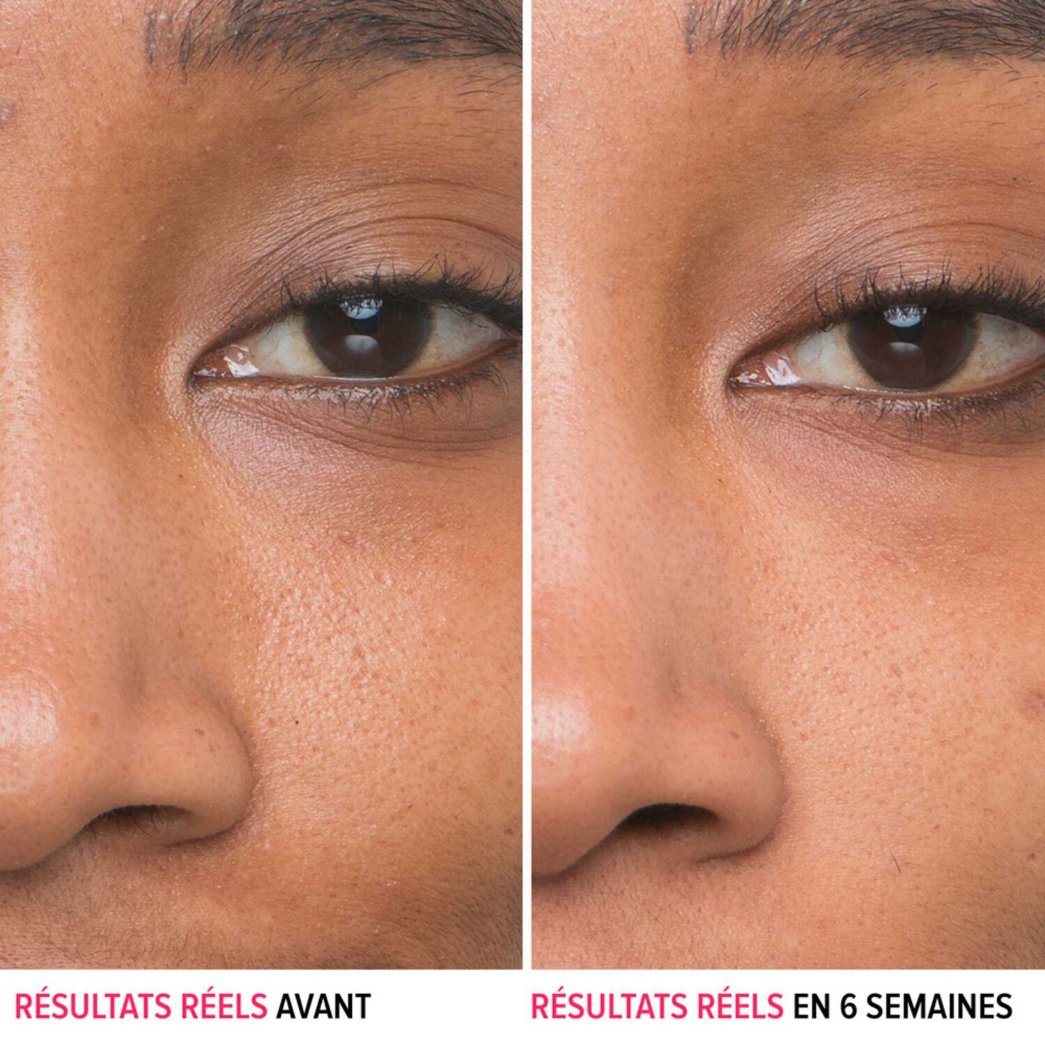 Bye Bye Pores - Sérum Anti-Pores Visibles à l'Acide Glycolique 30 ml
