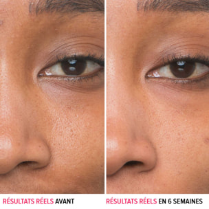 Bye Bye Pores - Sérum Anti-Pores Visibles à l'Acide Glycolique 30 ml