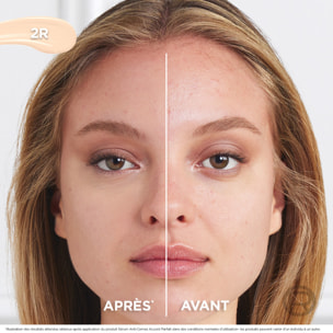 L'Oréal Paris Sérum Anti-Cernes Accord Parfait 2R 11ml