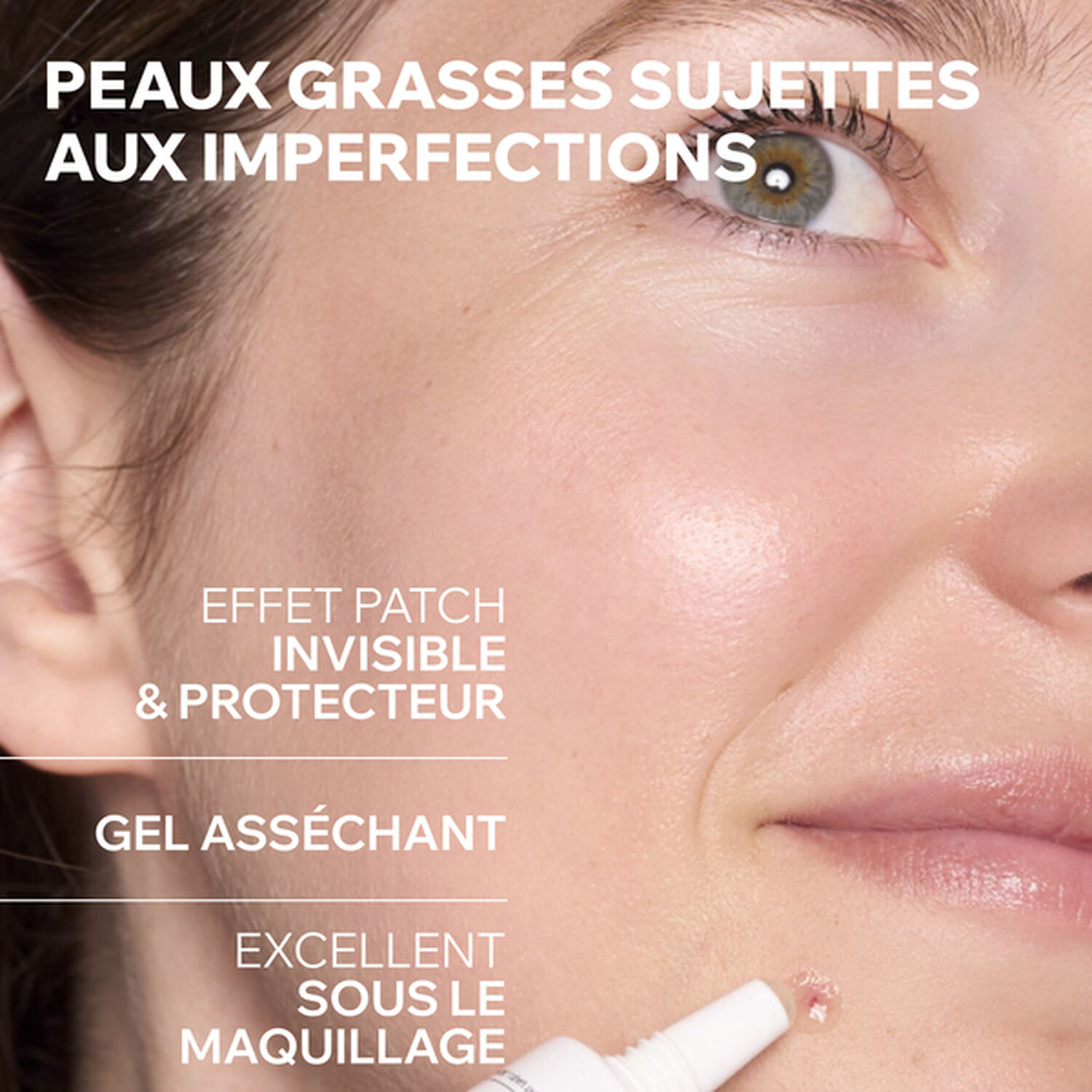 Hyséac  - Gel SOS Asséchant 15 ml