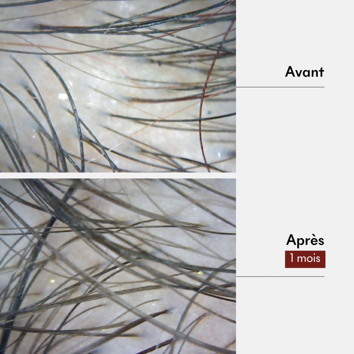 Boue Tricho-Force - Pré-Shampoing Anti-Chute 180 ml