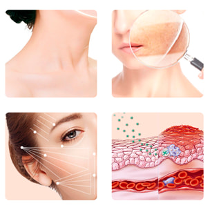 Instrumento de belleza EMS con modo de iones y 3 intensidades de corriente.