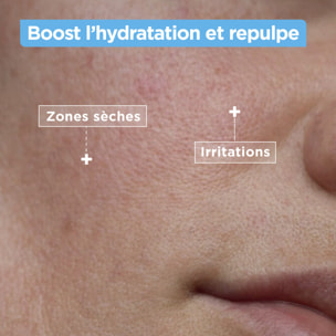 Mixa Nettoyant Confort Anti-sécheresse au Squalane et Acide Hyaluronique 150 ml