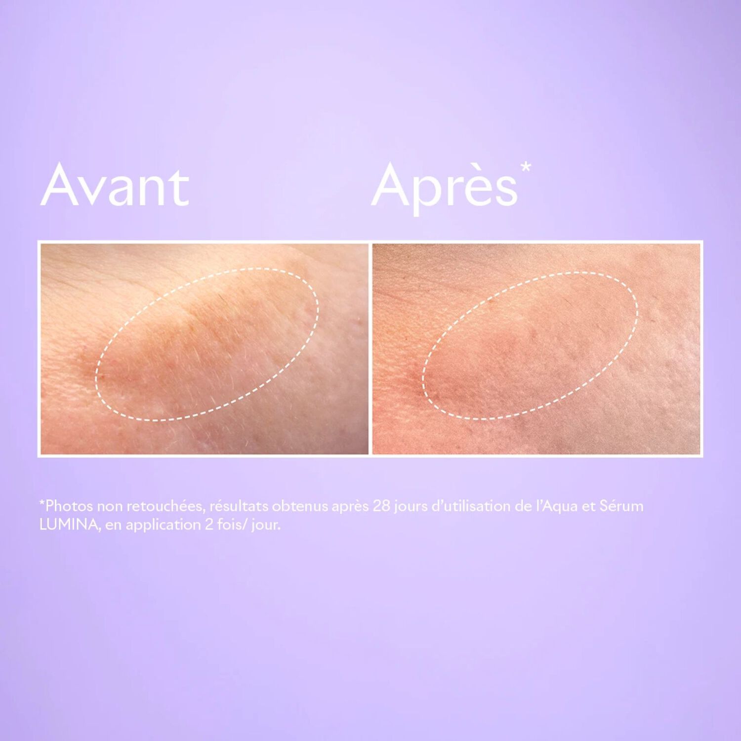 Lumina - Serum Eclat Anti-Taches 30 ml