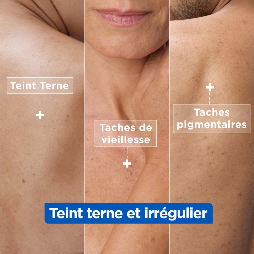 Mixa Crème Niacinamide Correction Éclat 400ml