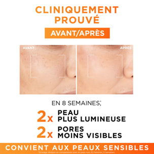 L'Oréal Paris Routine Eclat Sérum Vitamine C Teint Lumineux 30ml + Peeling Toner Réducteur de pores Vitamine C - 180ml