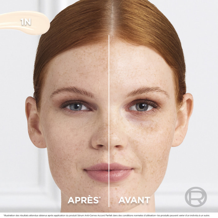 L'Oréal Paris Sérum Anti-Cernes Accord Parfait 1N 11ml