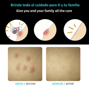 Alivio de picaduras y mordeduras de insectos. Tratamiento sin productos químicos de las picaduras y mordeduras.