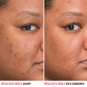 Bye Bye Darkspots - Sérum Anti-Tâches au Niacinamide 30 ml