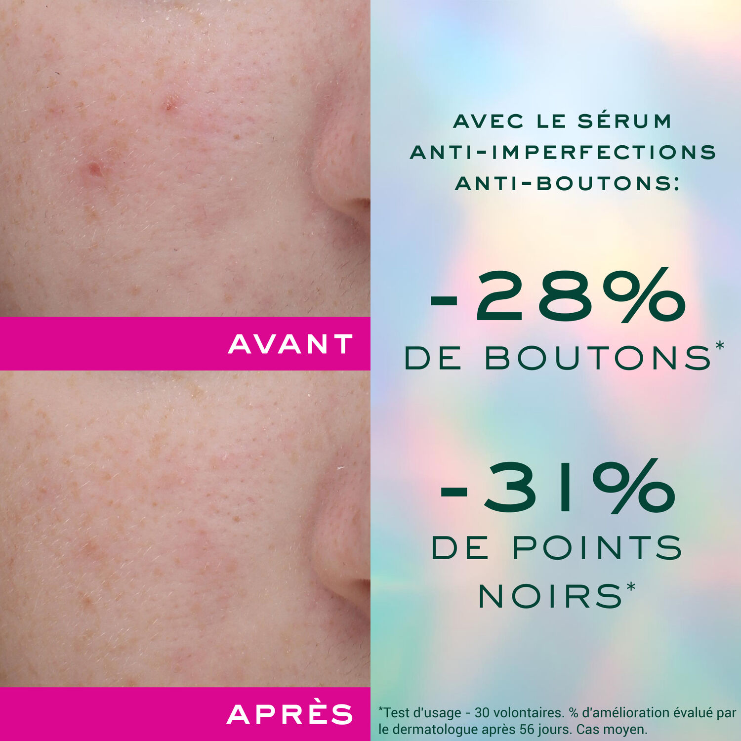 Zinc Power - Sérum Anti-Imperfections Anti-Boutons 30ml