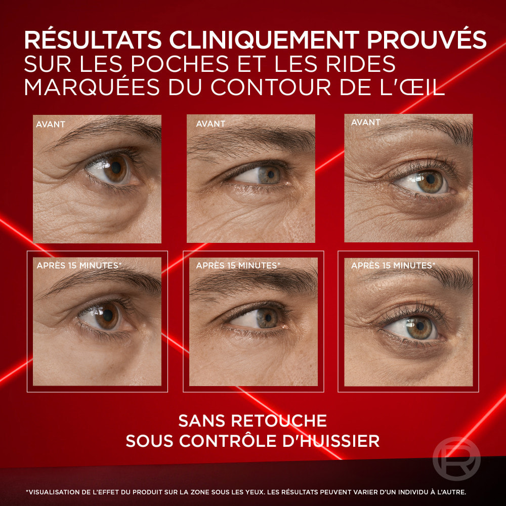 L'Oréal Paris Revitalift Laser Correcteur de poches instantané 15ml