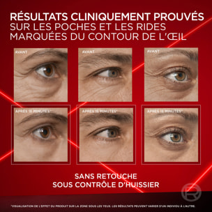 L'Oréal Paris Revitalift Laser Correcteur de poches instantané 15ml