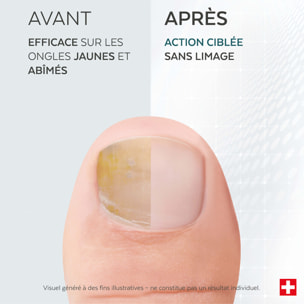 Tea Tree - Sérum Réparateur Ongles 6ml