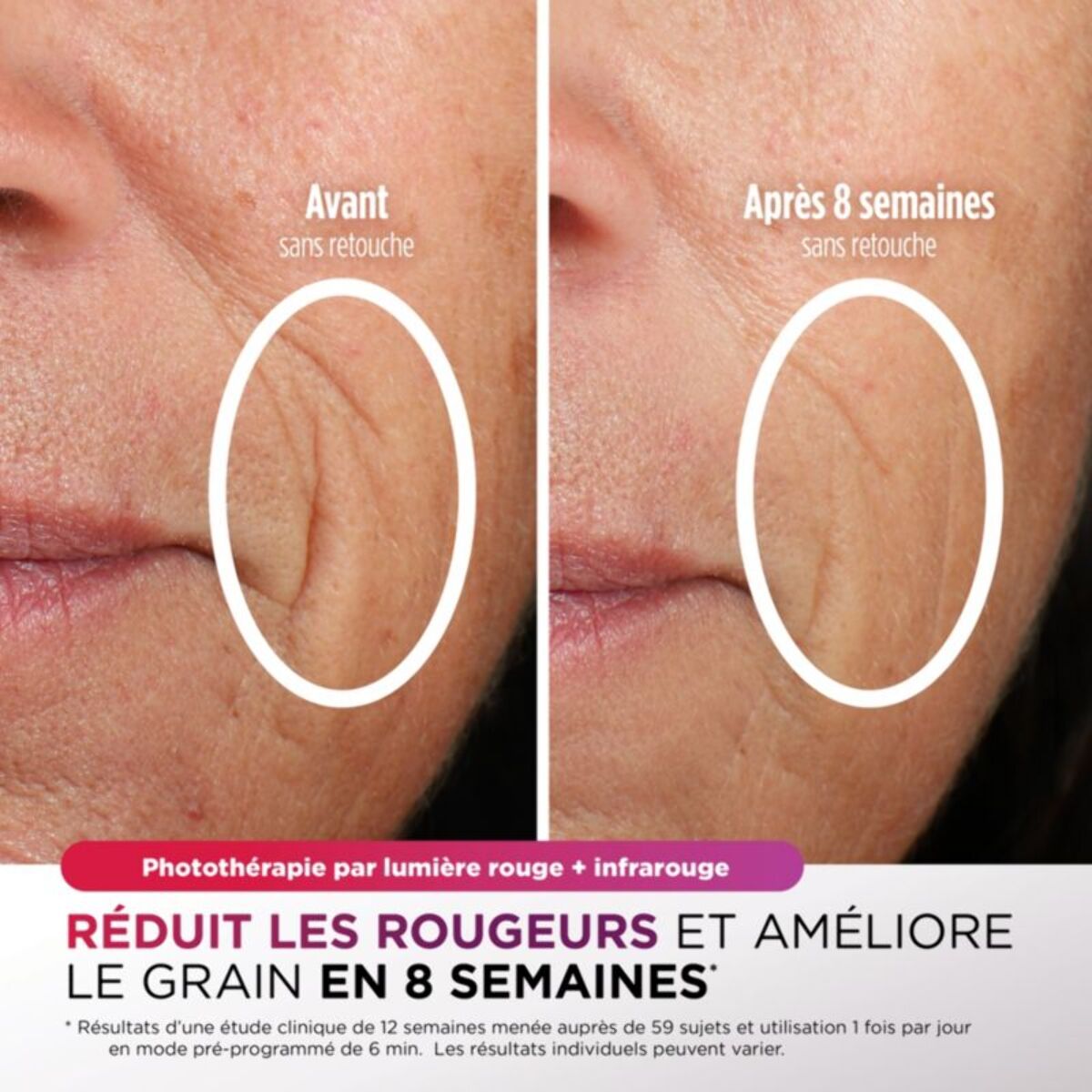 Masque LED SHARK CryoGlow avec rafraîchissement du contour des yeux Lilas