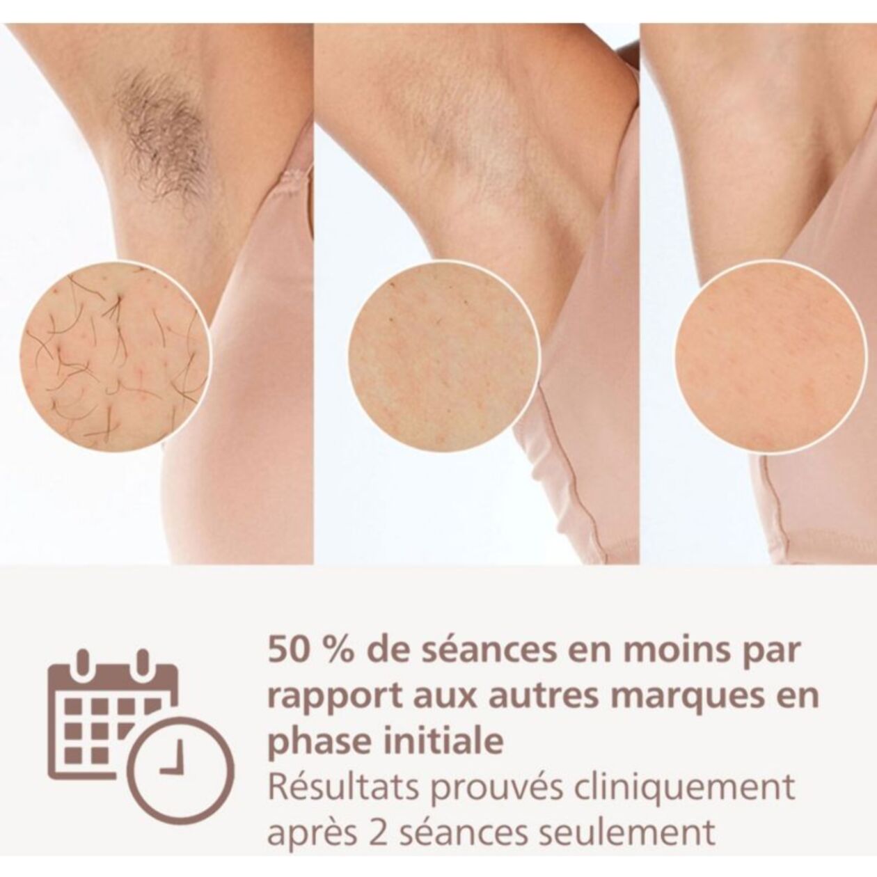 Epilateur lumière pulsée PHILIPS Lumea série 7000 BRI923/00