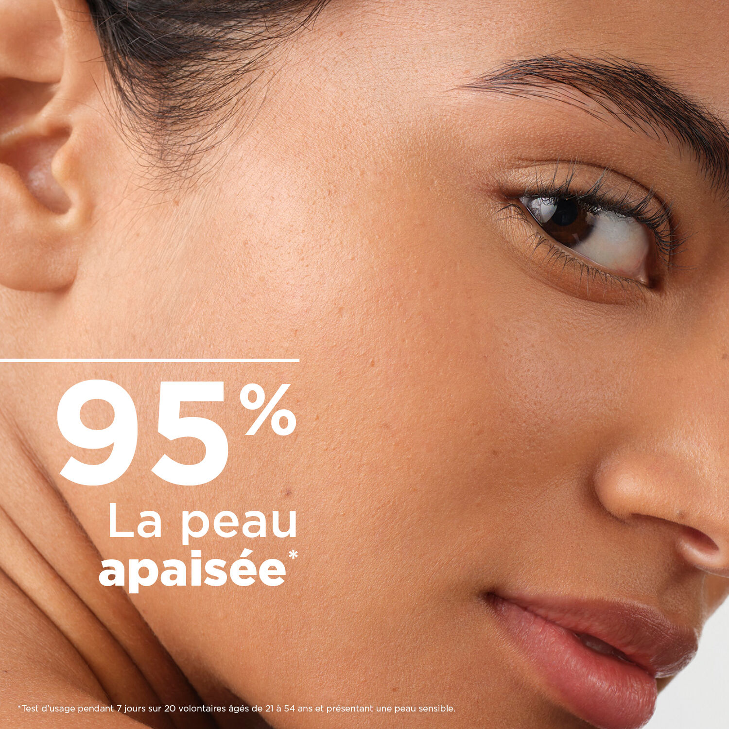 Créaline Fort - Crème Apaisante Action Rapide - Peaux Rougies & Échauffées 40 ml