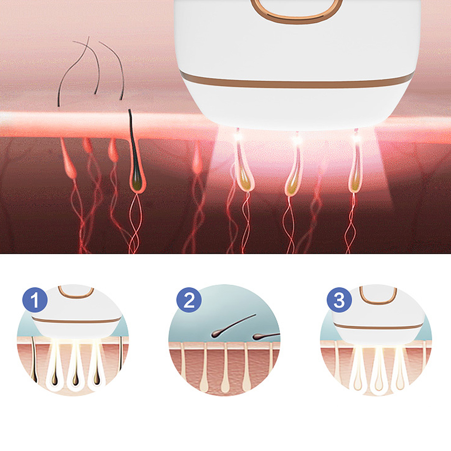 T5S Depiladora IPL de luz pulsada. Cabezal reemplazable. Alta intensidad 999,999.