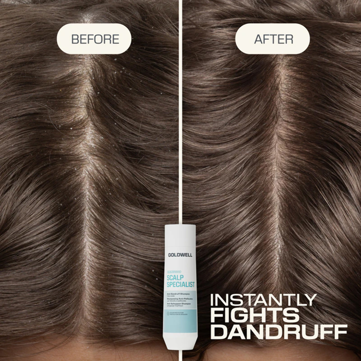 GOLDWELL DS Scalp Specialist Anti-Dandruff Shampoo 250ml