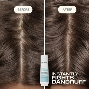 GOLDWELL DS Scalp Specialist Anti-Dandruff Shampoo 250ml
