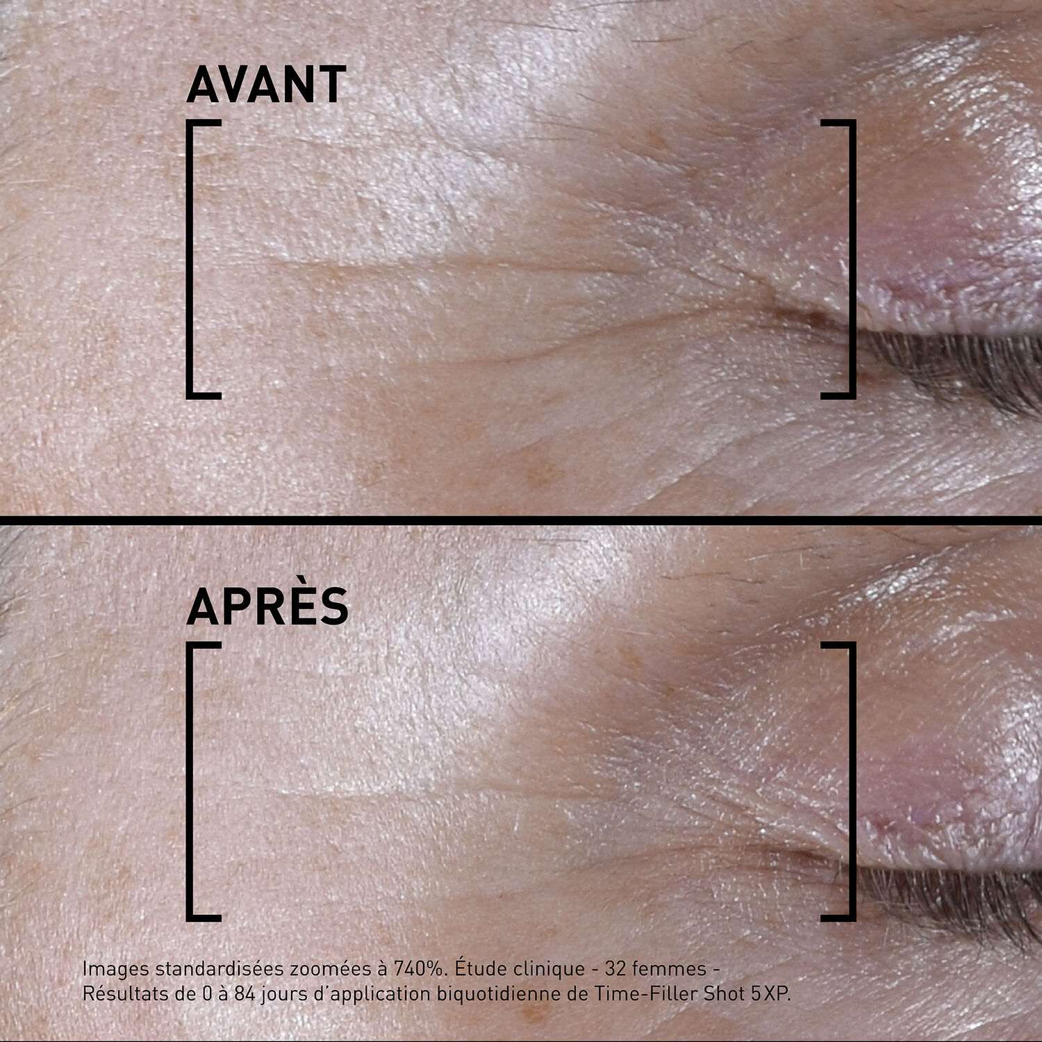 Time-Filler Shot 5XP - Sérum Concentré – correction rides d’expression visibles 15 ml
